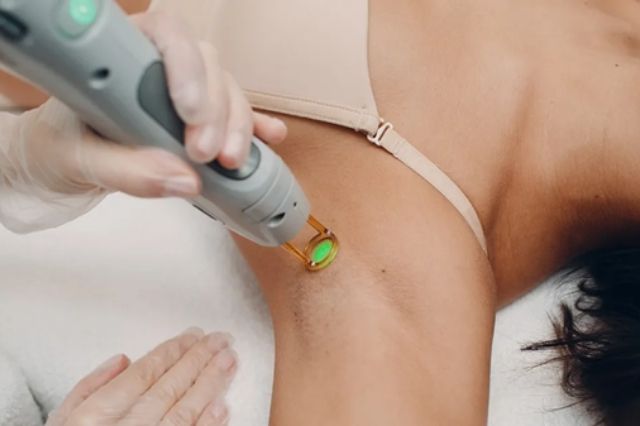 the-benefits-of-ipl-underarm-hair-removal