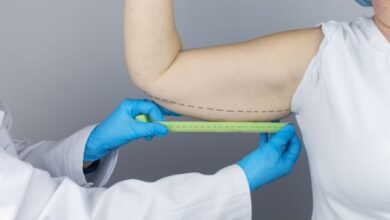 things-you-should-know-about-non-surgical-arm-lifts