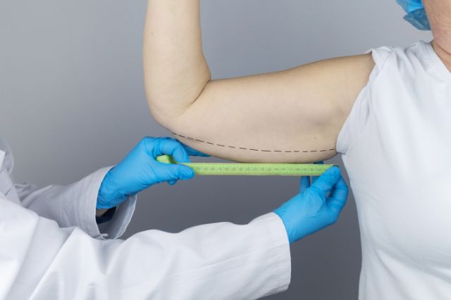 things-you-should-know-about-non-surgical-arm-lifts